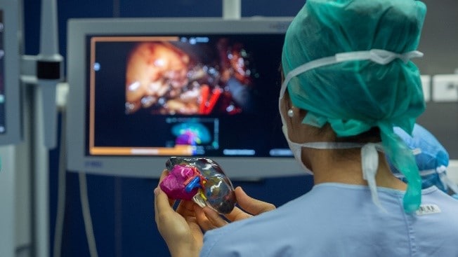 La technologie unique d'impression 3D Stratasys permet au CHU de Bordeaux d'imprimer des modèles ultra-réalistes de reins de patients.