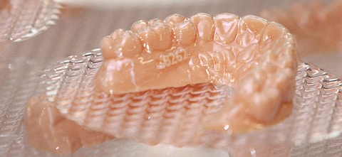 3D printed dental molds for the Orthodontics and Dental Industry