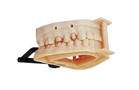 3D printed dentures