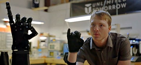 Unlimited Tomorrow Advances Prosthetics with 3D Printing