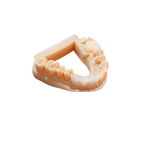 Objet Eden 260 VS Dental 3D printed part